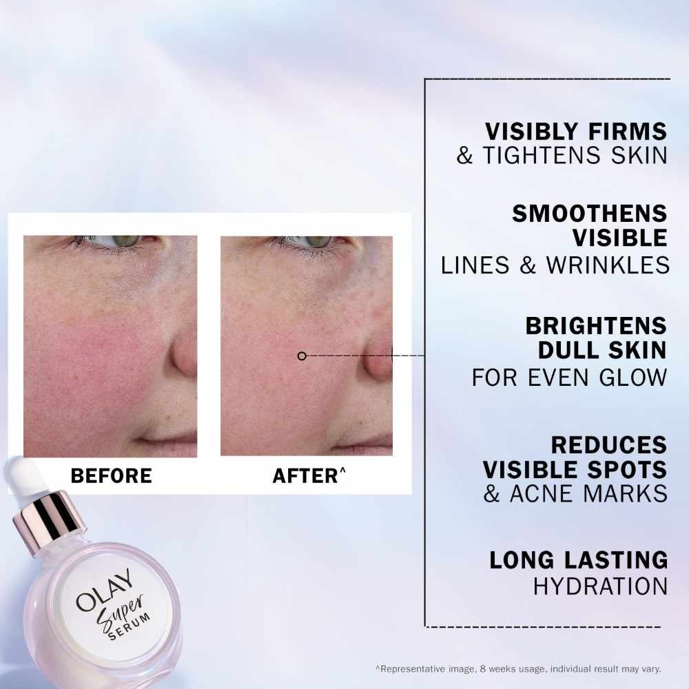 Super Serum (Firms, Smoothens, Evens Tone, Reduces Spots Appearance & Hydrates Skin) 30ml