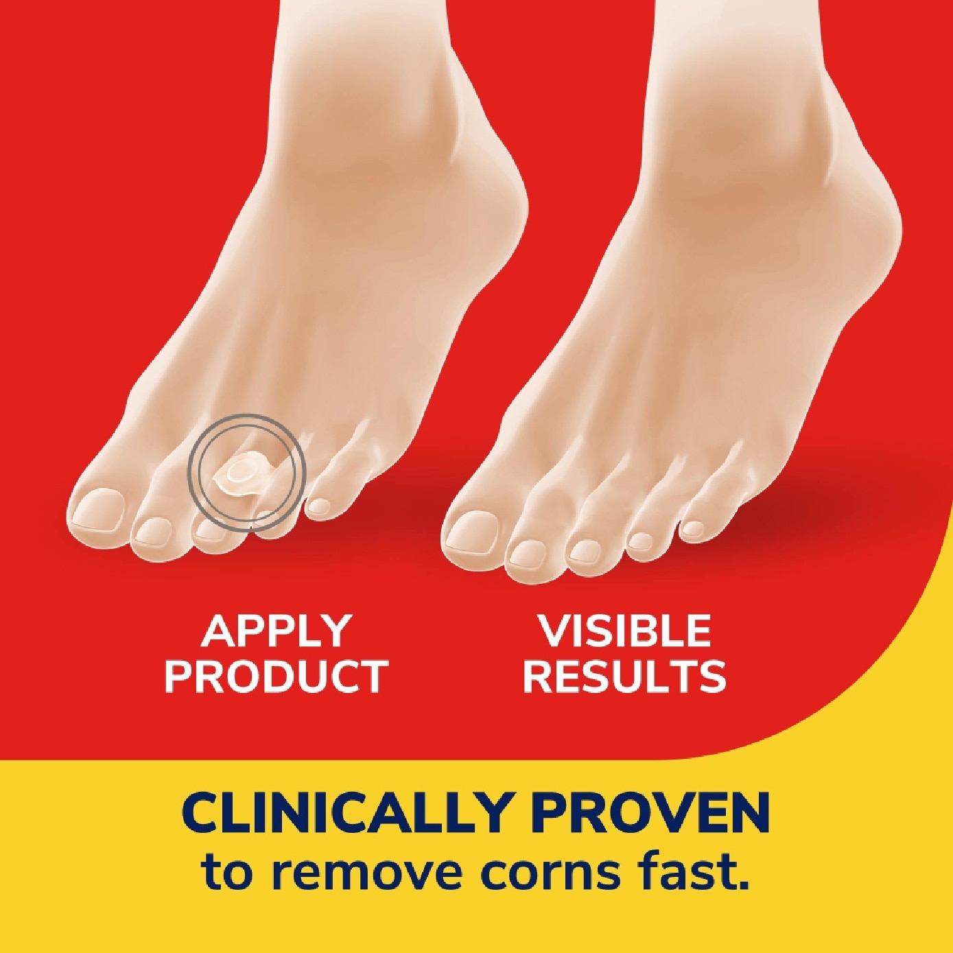 Corn Removers Seal & Heal Bandage 6s image