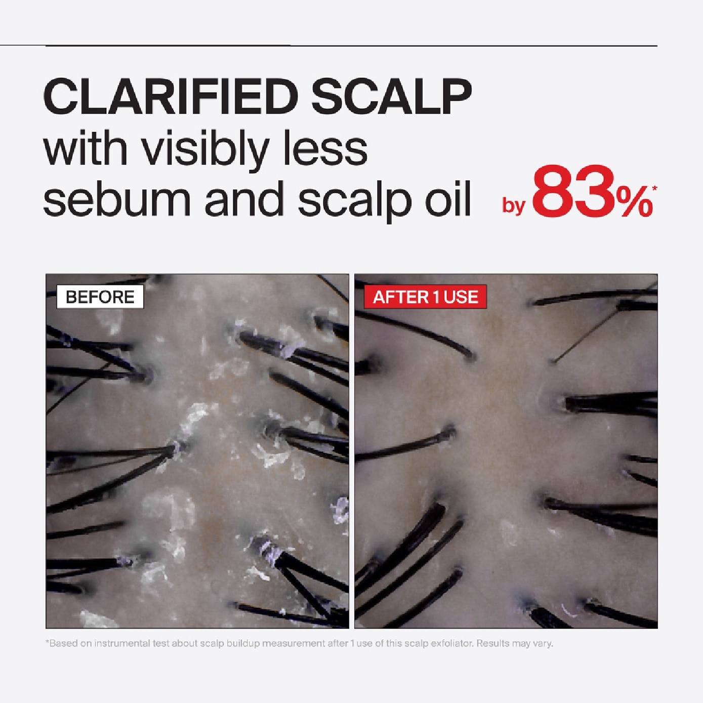 Folligen Thickening Sea Salt Scalp Exfoliator 250g image