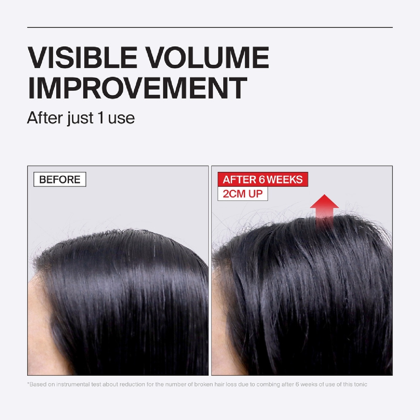 Folligen Thickening Scalp Tonic 120ml image