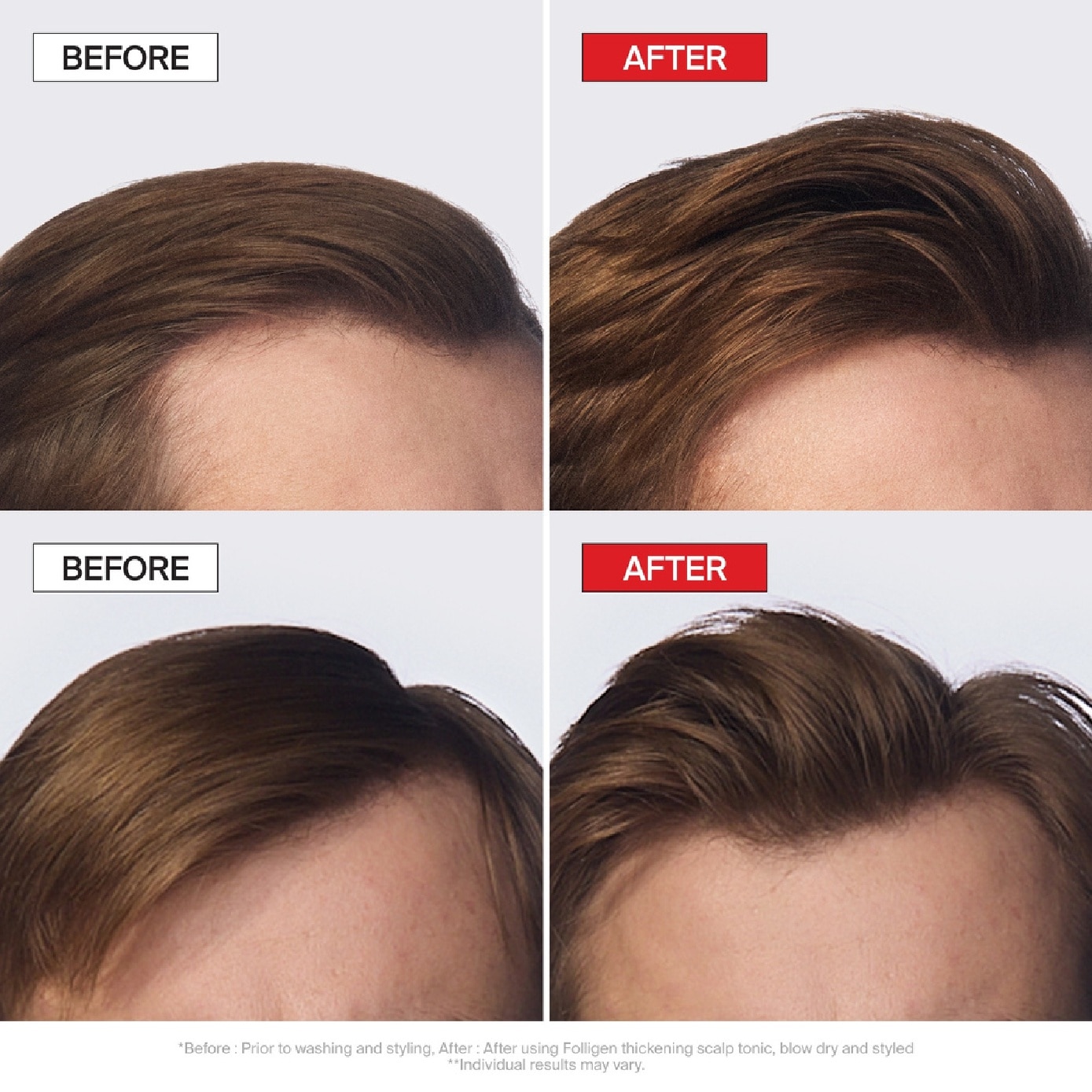 Folligen Thickening Scalp Tonic 120ml image