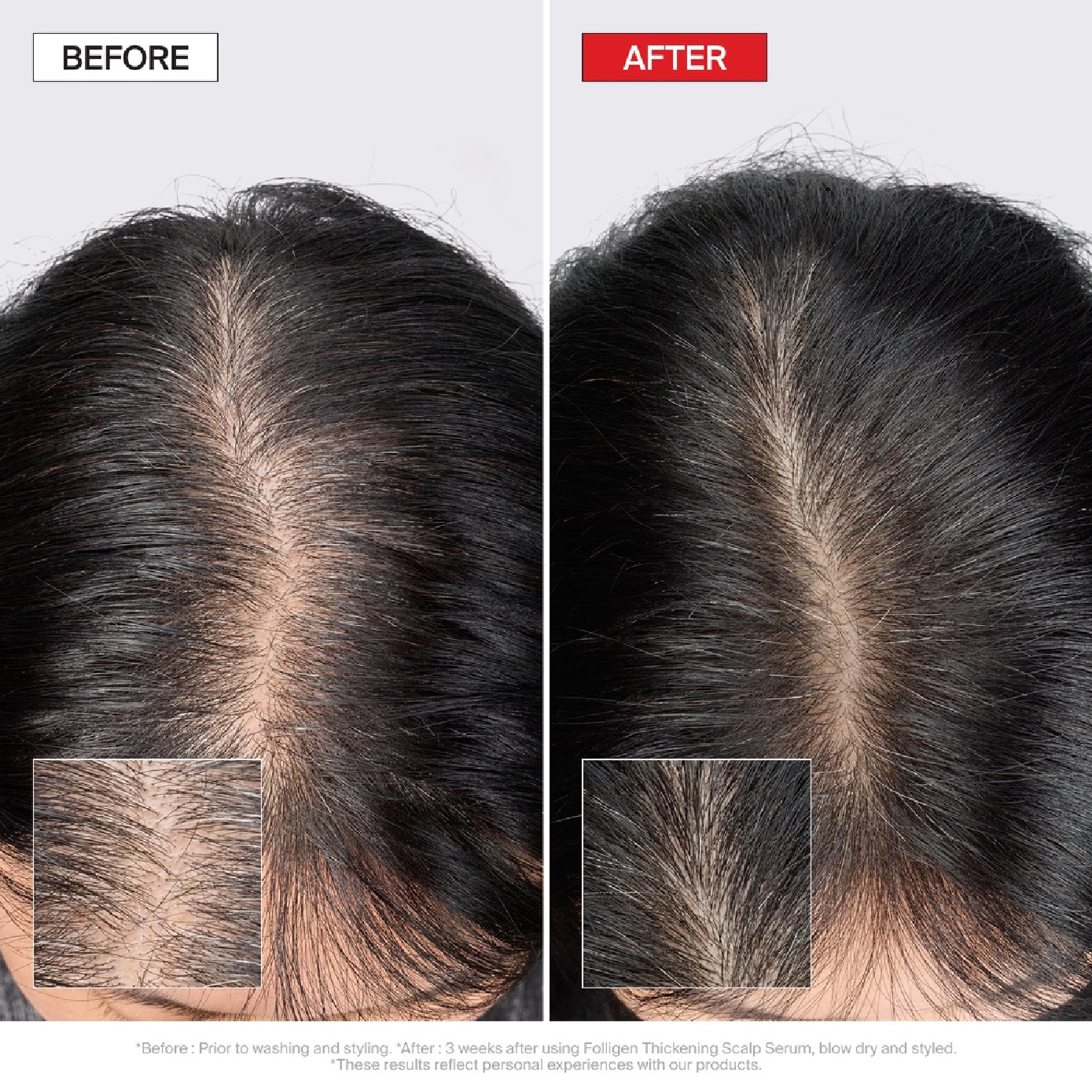 Folligen Thickening Scalp Serum 50ml image
