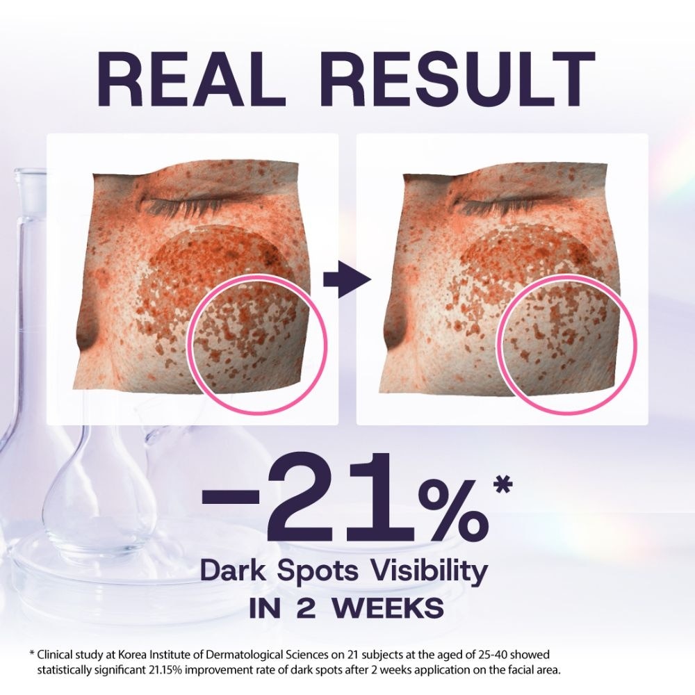 Whiten Shot Serum Sheet Mask 5s