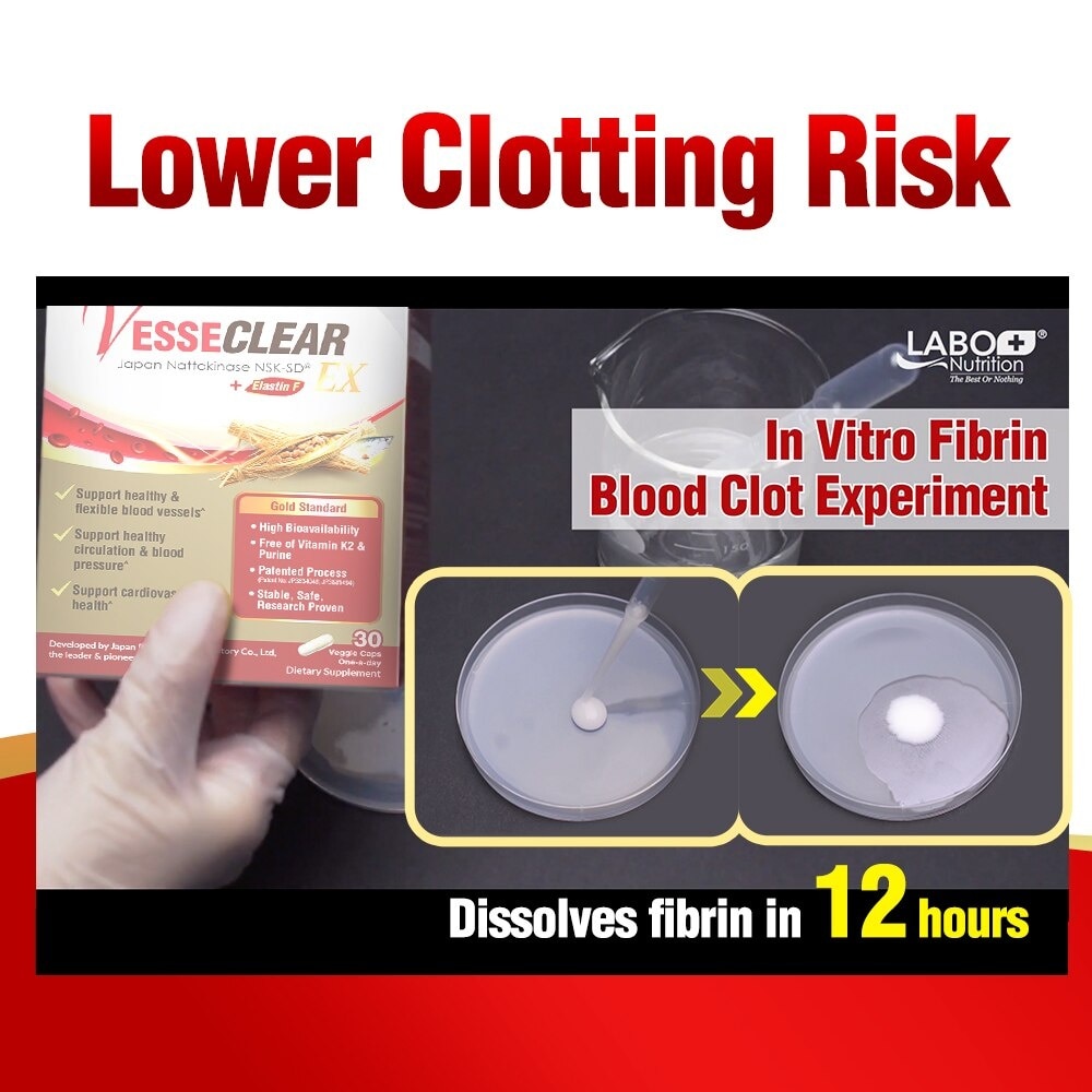 Vesseclear Ex Dietary Supplement Capsule (For Clean & Flexible Blood Vessel, Dissolve Clots For Blood Pressure, Circulation Support, And Cardiovascular Health) 30s