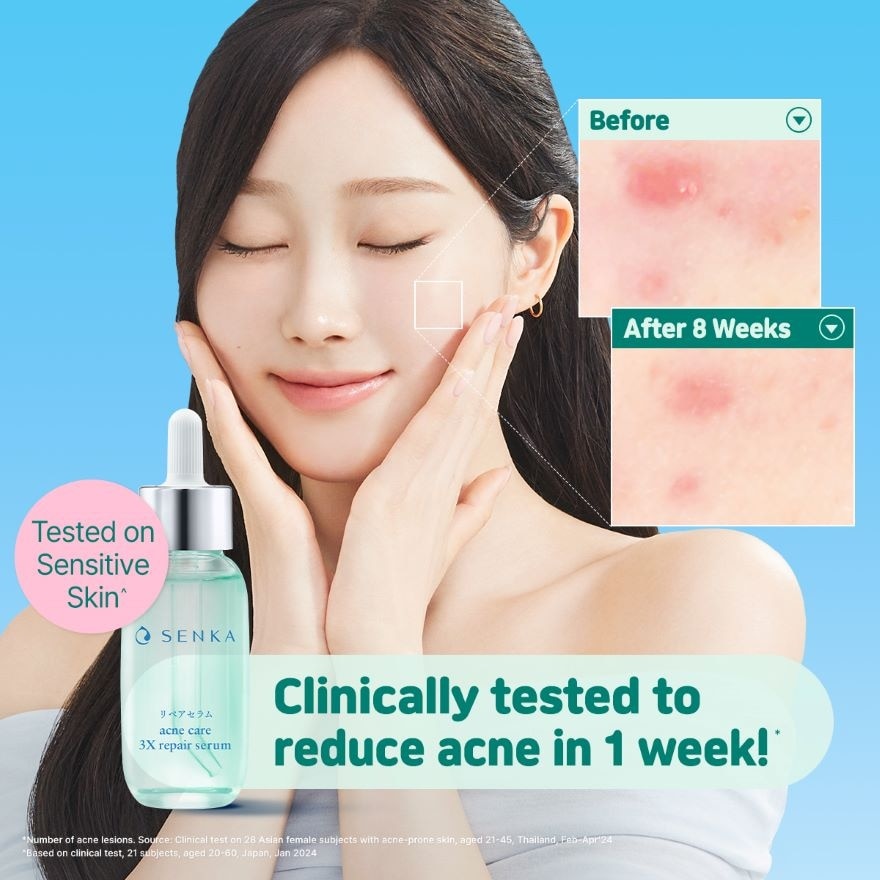 Acne Cair 3x Repair Serum 30ml