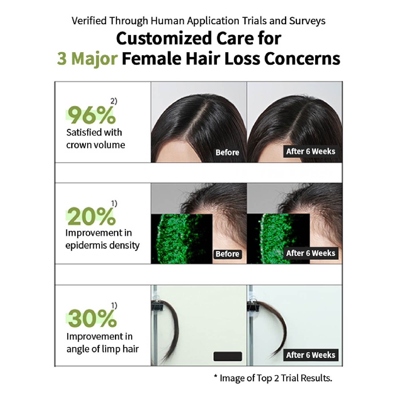 RootGen Hair Loss Care Shampoo For Women 515ml