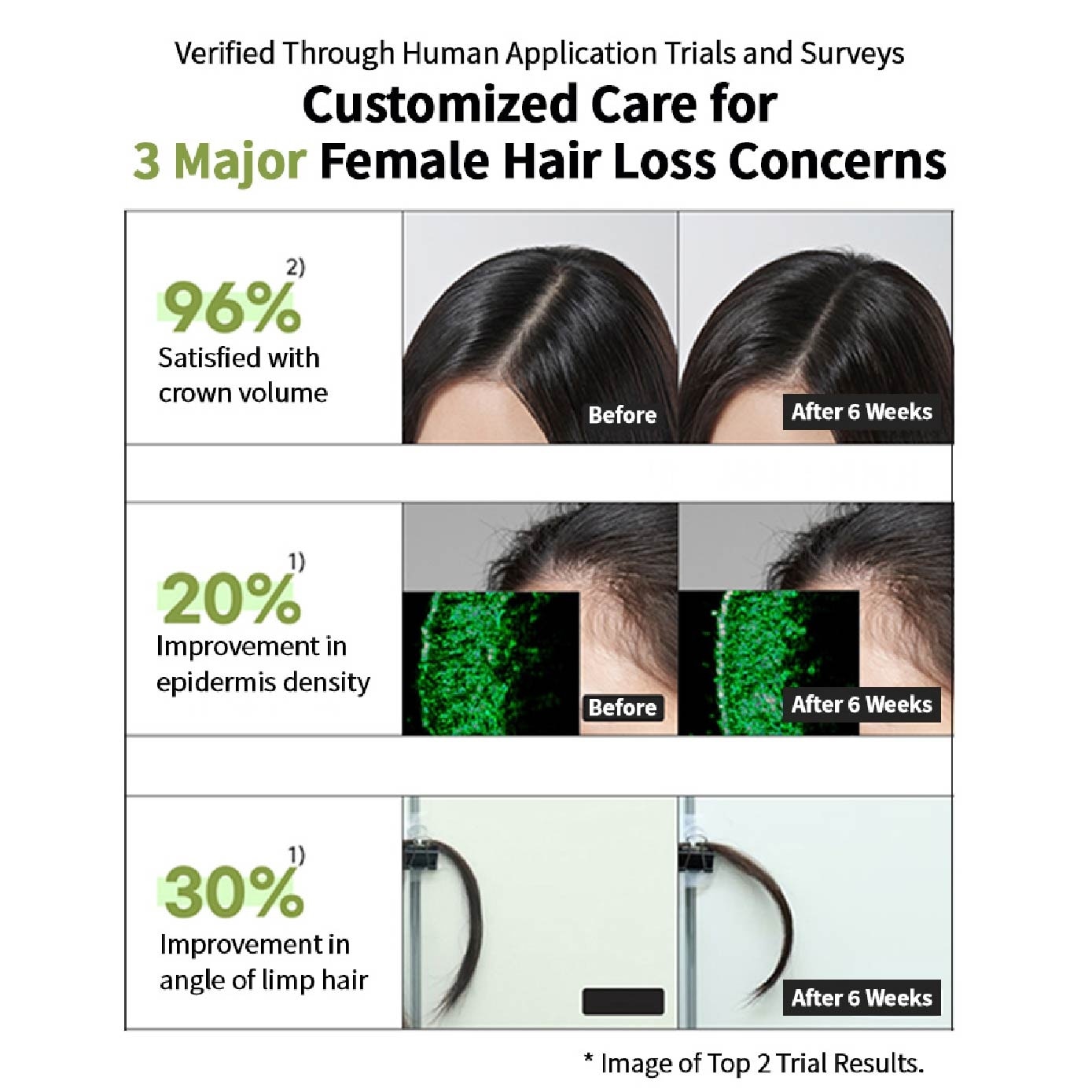 RootGen Hair Loss Care Shampoo For Women 515ml image