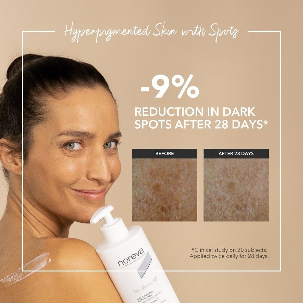 Trio White XP Anti-Dark Spot Body Lotion 400ml