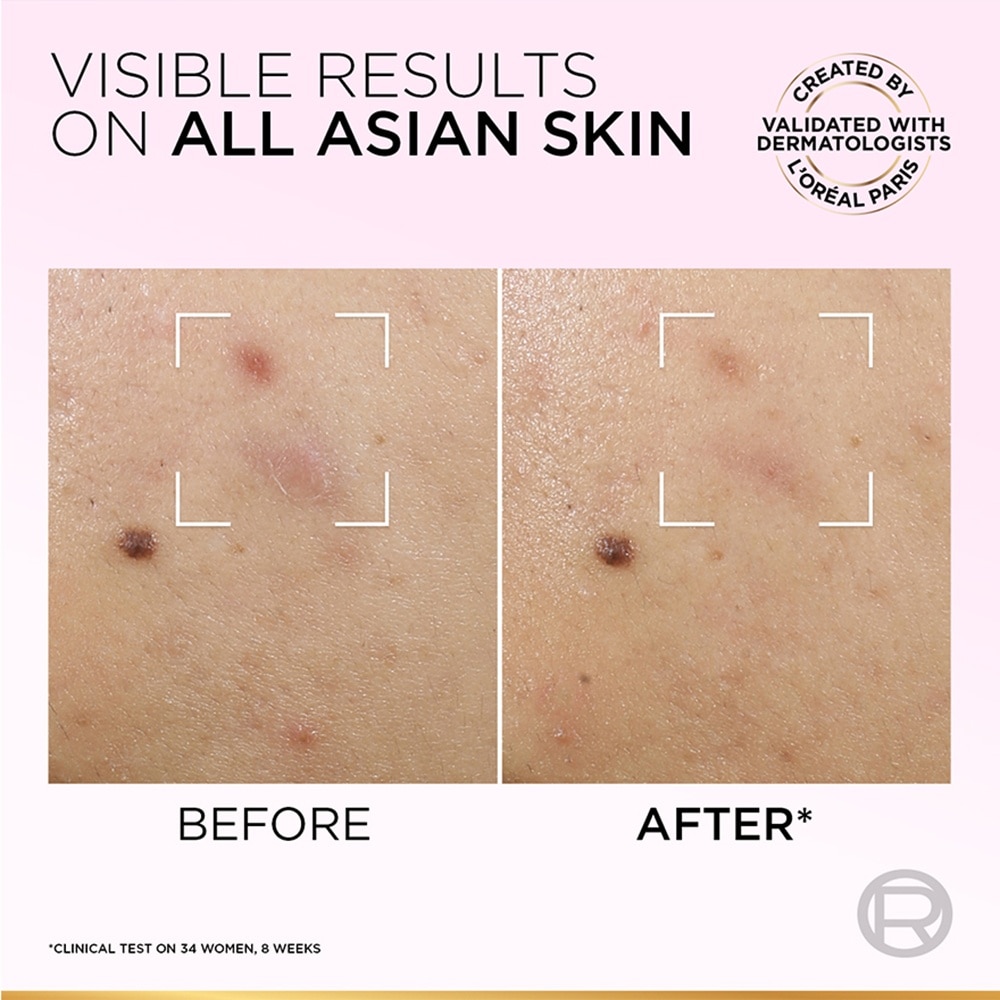 Glycolic-Bright 15% Exfoliant Peel 25ml