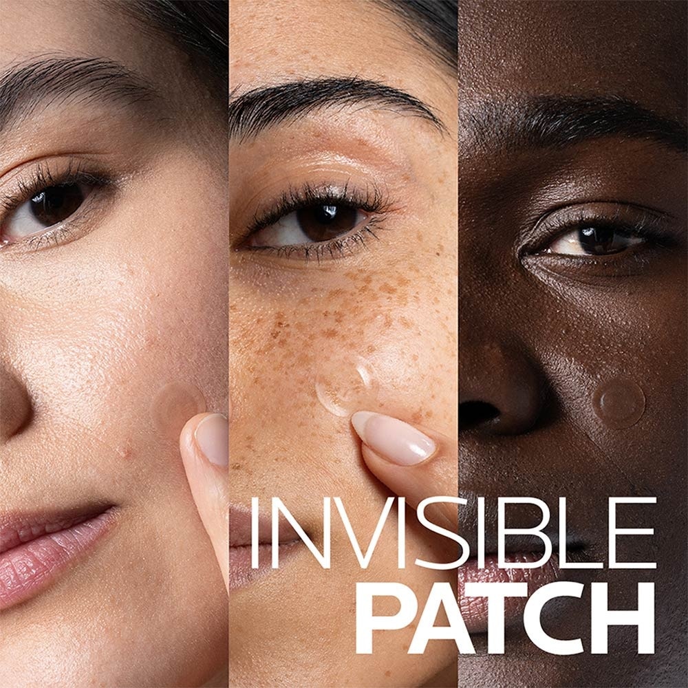 Effaclar Duo+M Patch 22s image