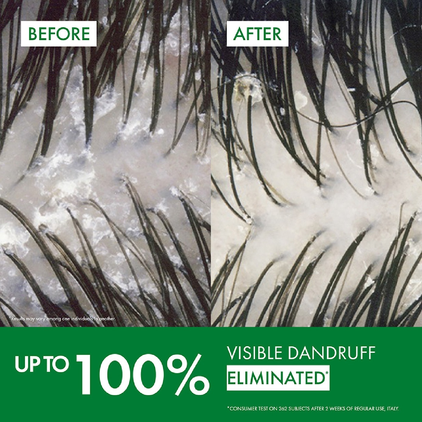 Dercos Anti-Dandruff Shampoo For Normal To Oily Hair 200ml