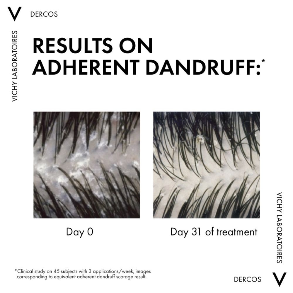 Dercos Anti-Dandruff Shampoo For Normal To Oily Hair 200ml