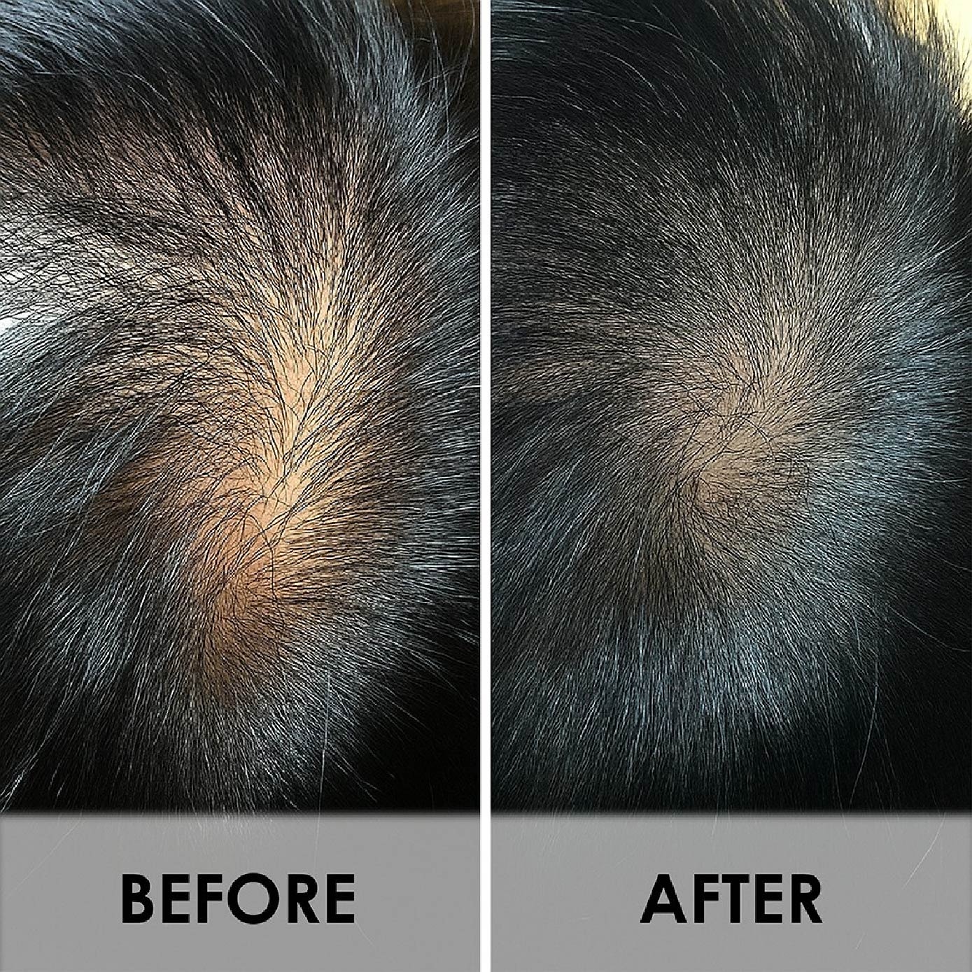 True Hair & Scalp Treatment 500g