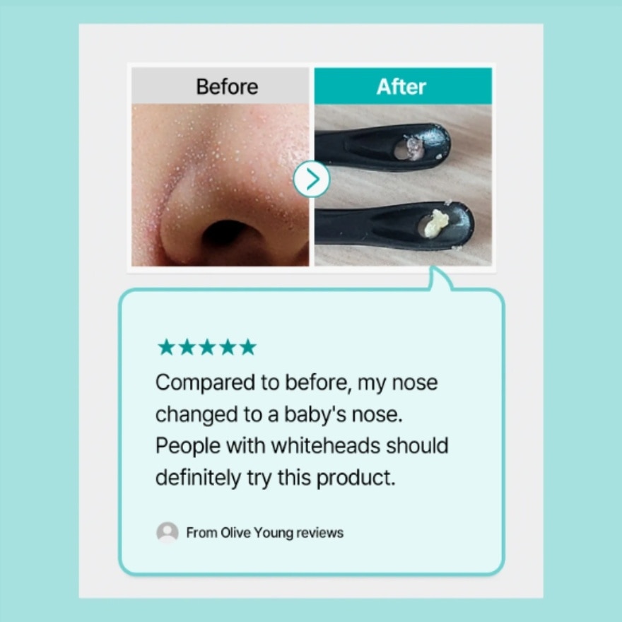 Natural Mild Clear Nose Patch 5s