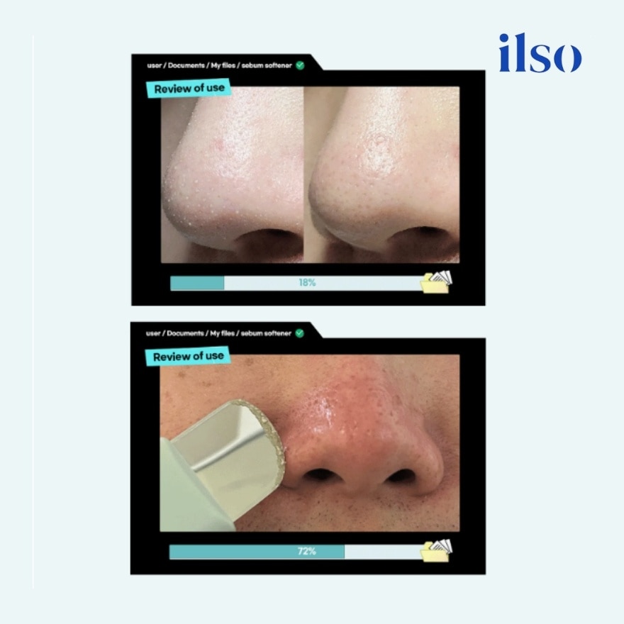 Super Melting Sebum Softener 150g