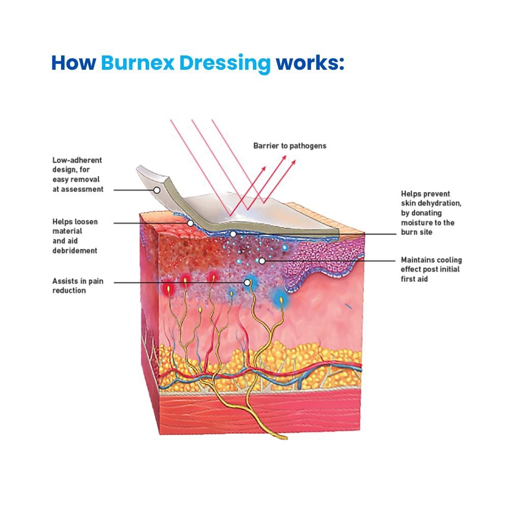 Hydrogel Burn Dressing 10x10cm 1s