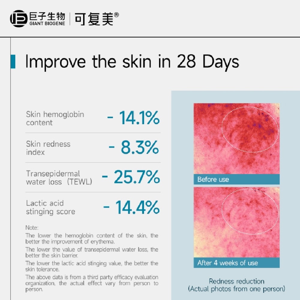 Recombinant Collagen Repair Mask 30g x 5s