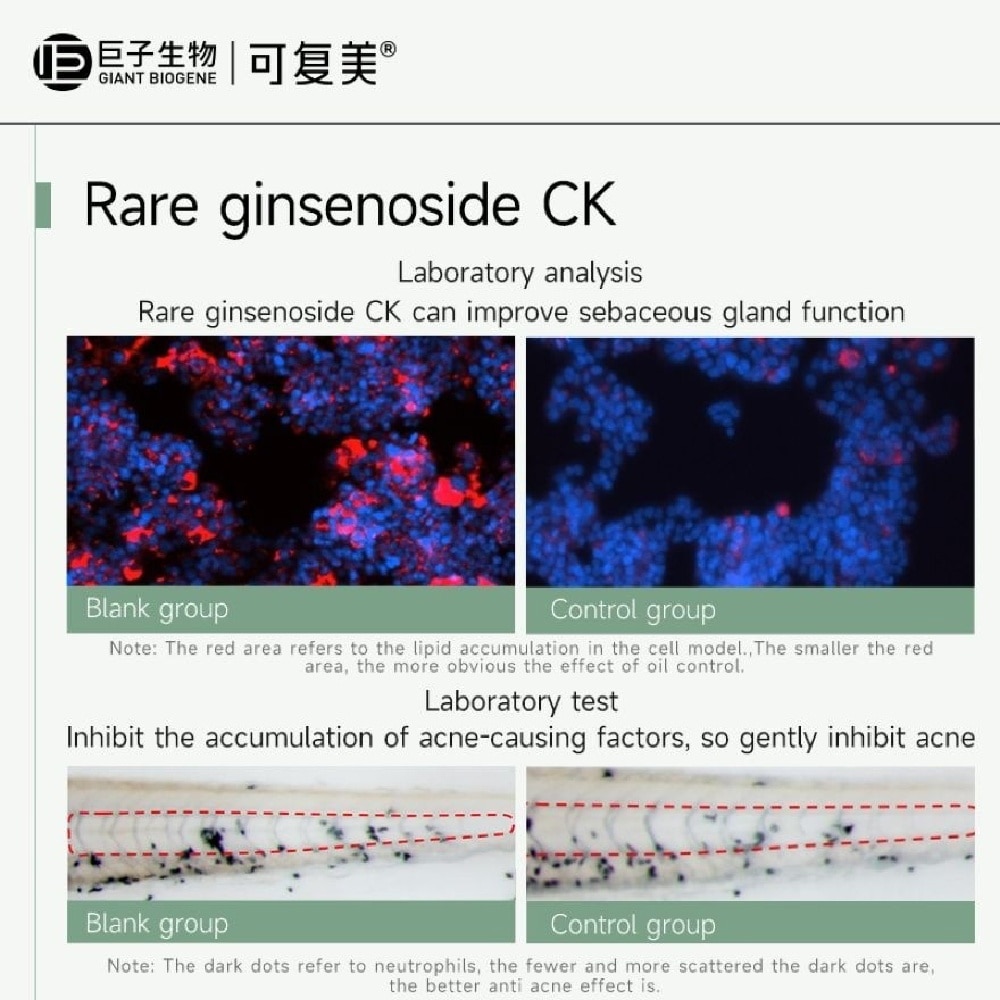 Rare Ginsenoside Acne Removing Essence (Day) 5ml