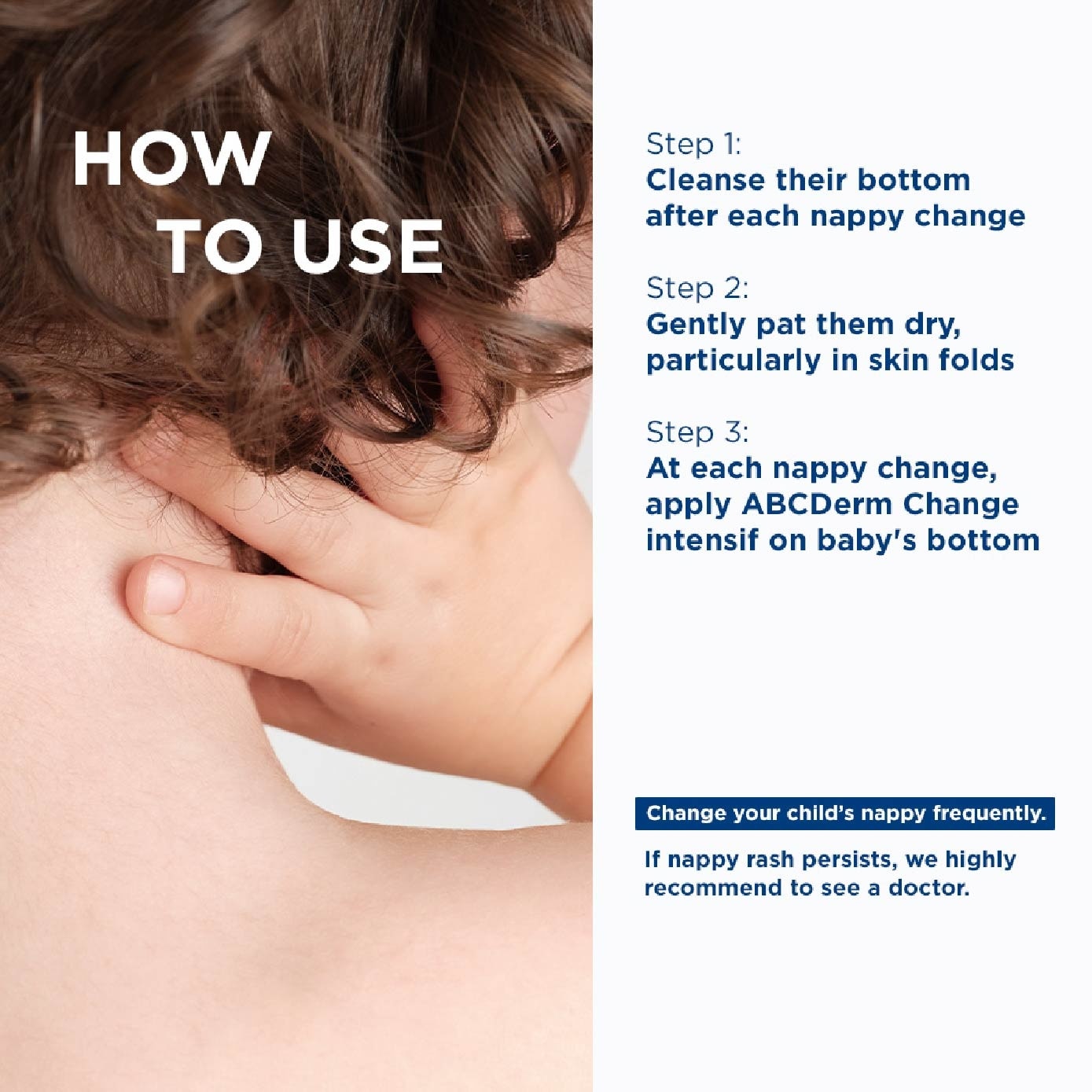 ABCDERM Change Intensif Nappy Rash Treatment Moisturiser (Babies and Children's Skin) 75g (Expiry: Jun`2027) image
