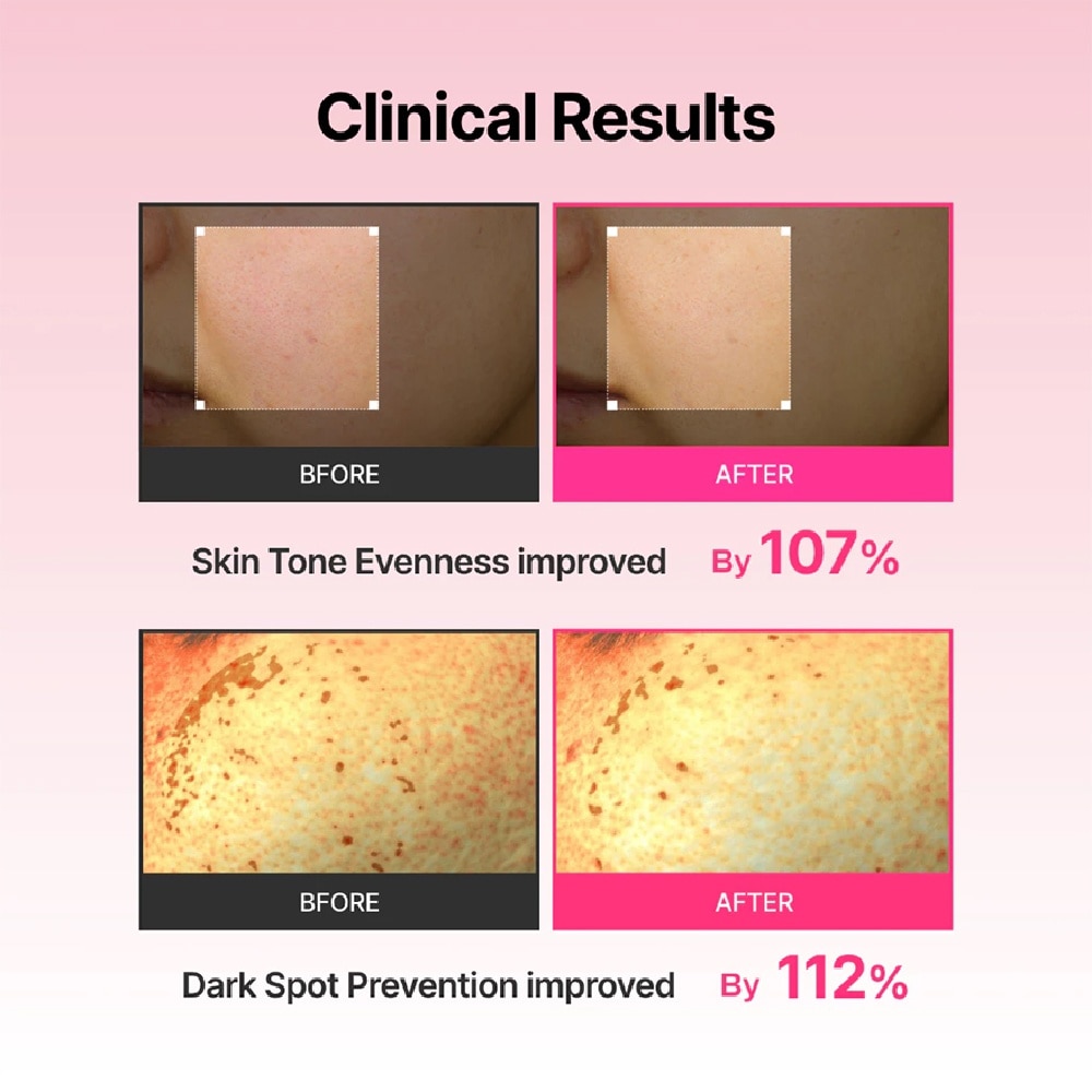 Arbutin Skin Booster Serum With Device Set 150ml