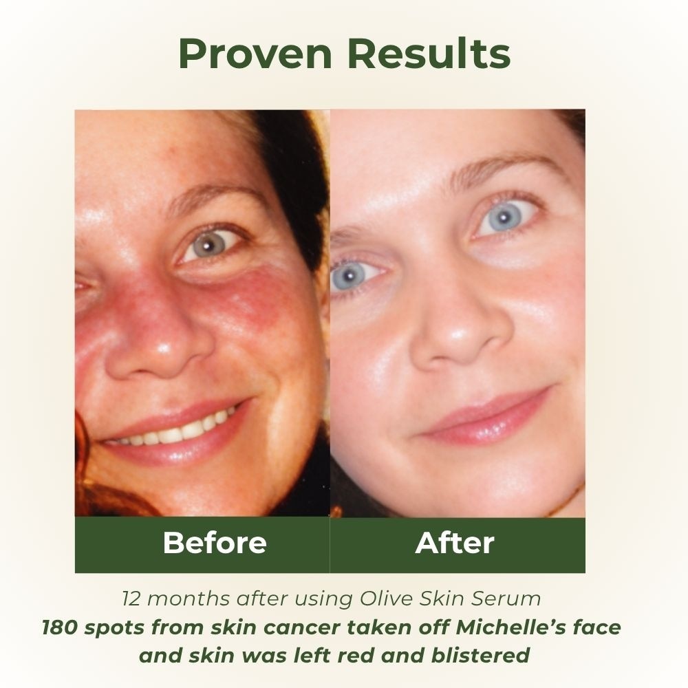 Olive Anti-Ageing Skin Serum 15ml