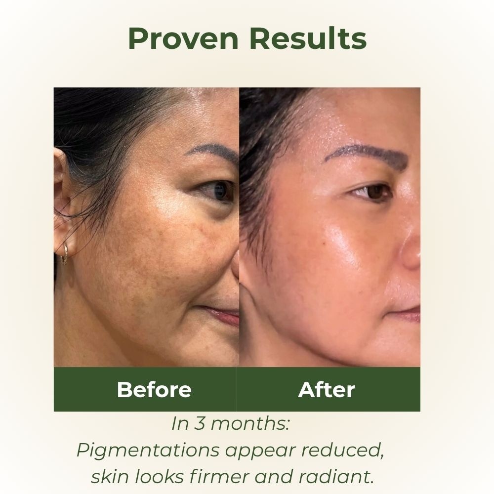 Acai Berry Active Antioxidant Serum 15ml