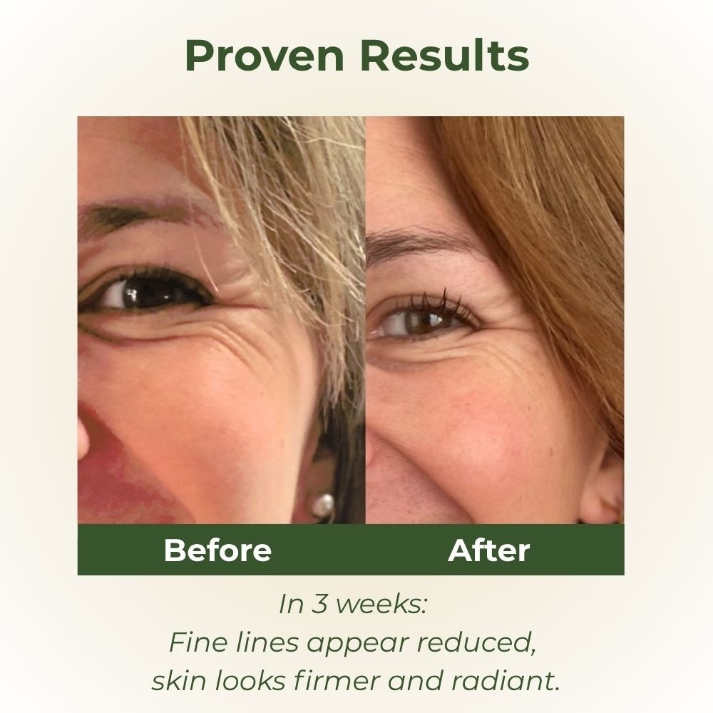 PhytoCollagen + Vitamin B3 Serum 30ml