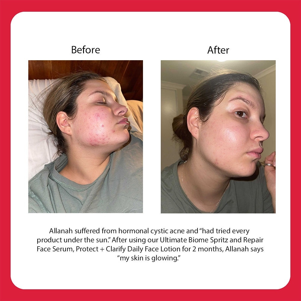 Ultimate Biome Spritz 50ml