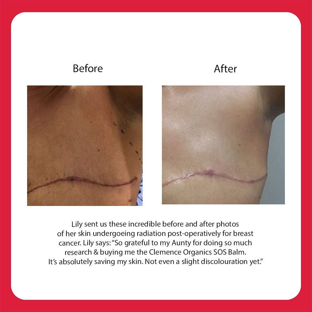 Ultimate SOS Balm 15ml