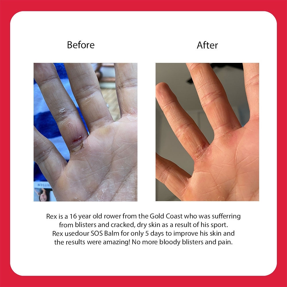 Ultimate SOS Balm 60ml