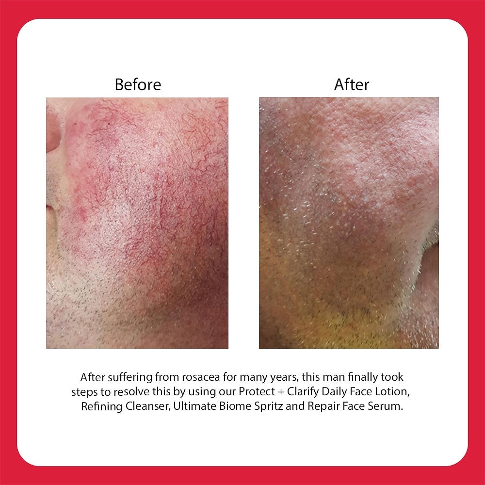 Protect + Clarify Daily Face Lotion 50ml