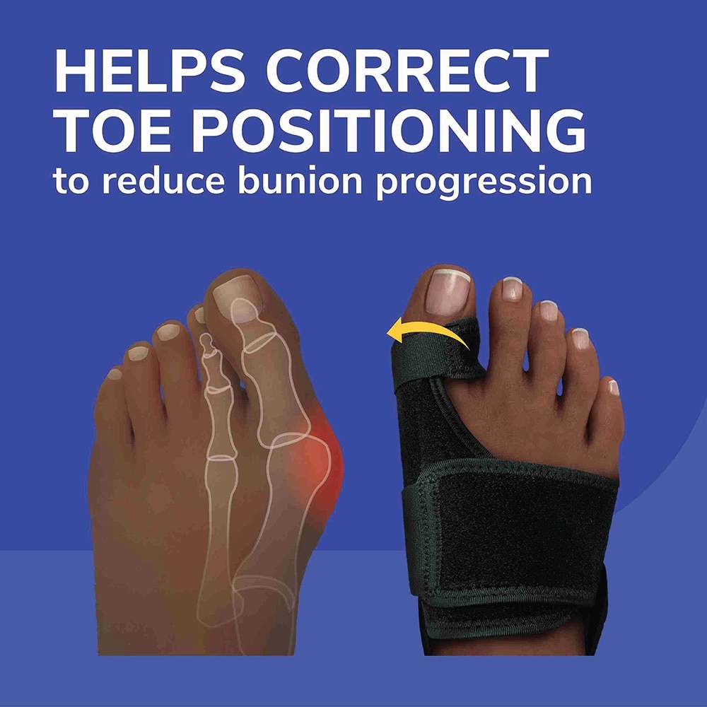 Bunion Relief & Toe Corrector 1s