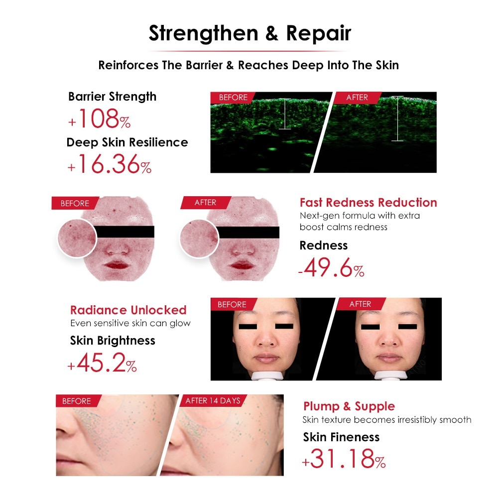 Sensitiveness Relieving Moisturizing Tolerance-Extreme Essence 30ml