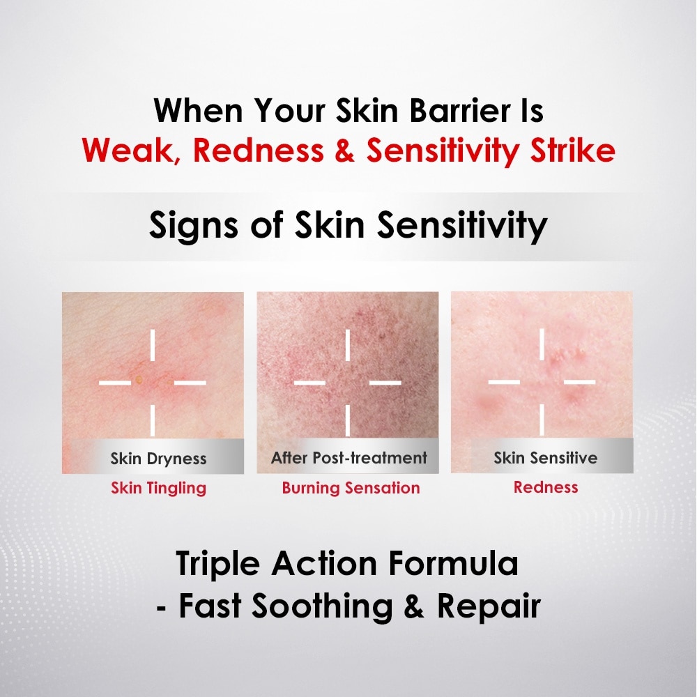 Sensitiveness Relieving Moisturizing And Smoothing Face Mask 6s