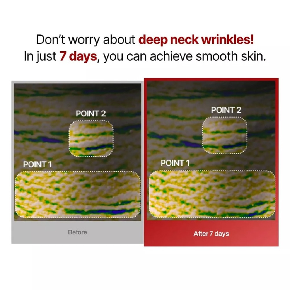 Wrinkle-Fit Neck Mask 10g x 7s