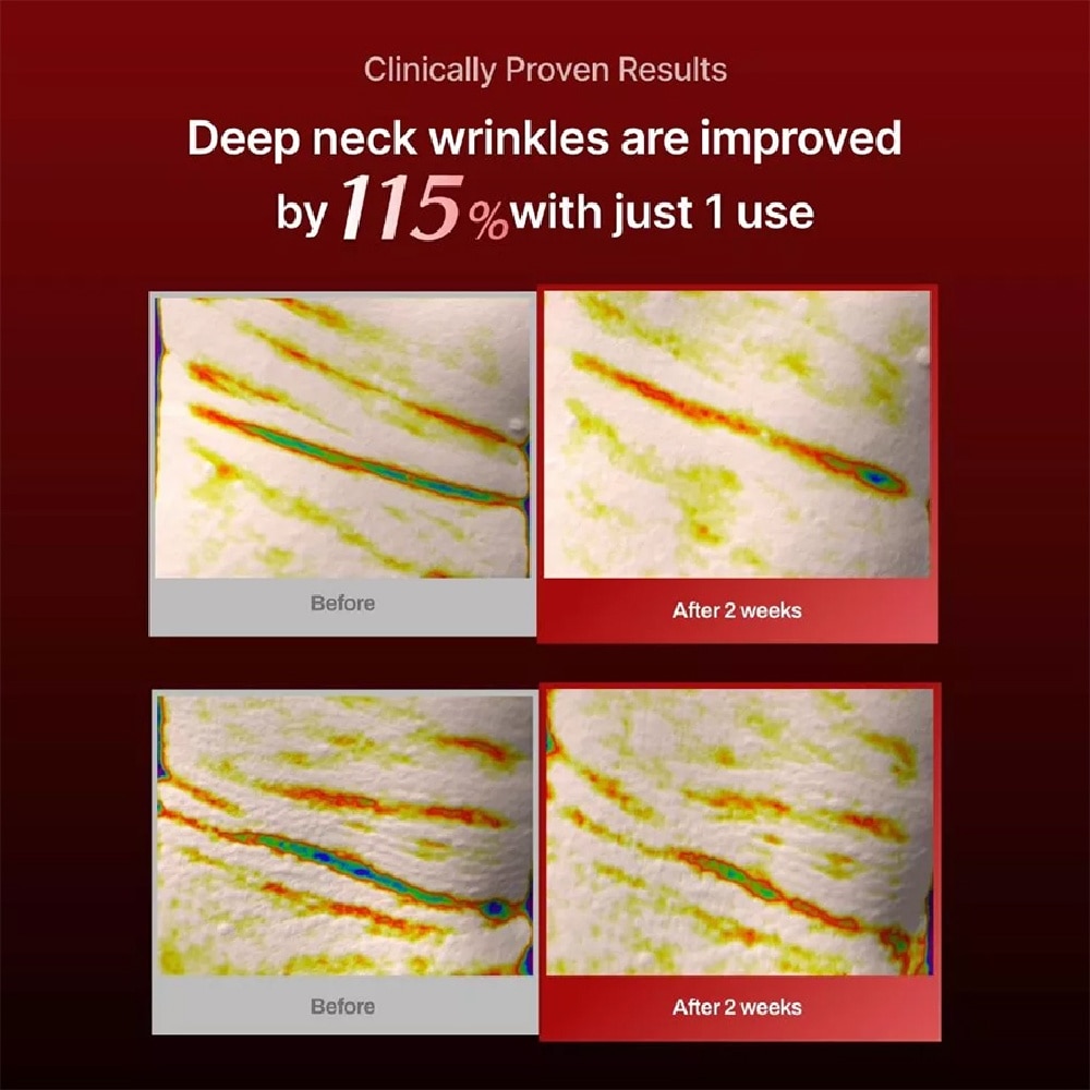 Wrinkle-Fit Neck Mask 10g x 7s