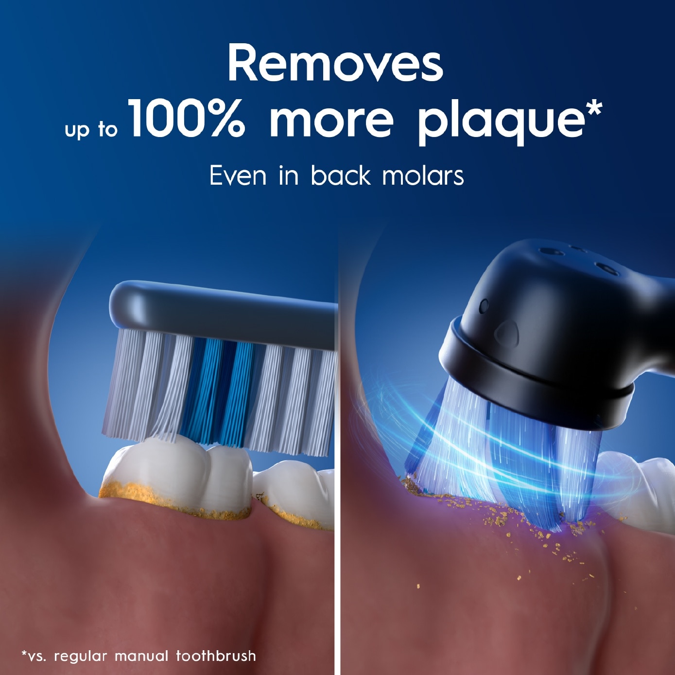 iO Series 2 Gentle Clean Sensitive Black Electric Toothbrush 1s