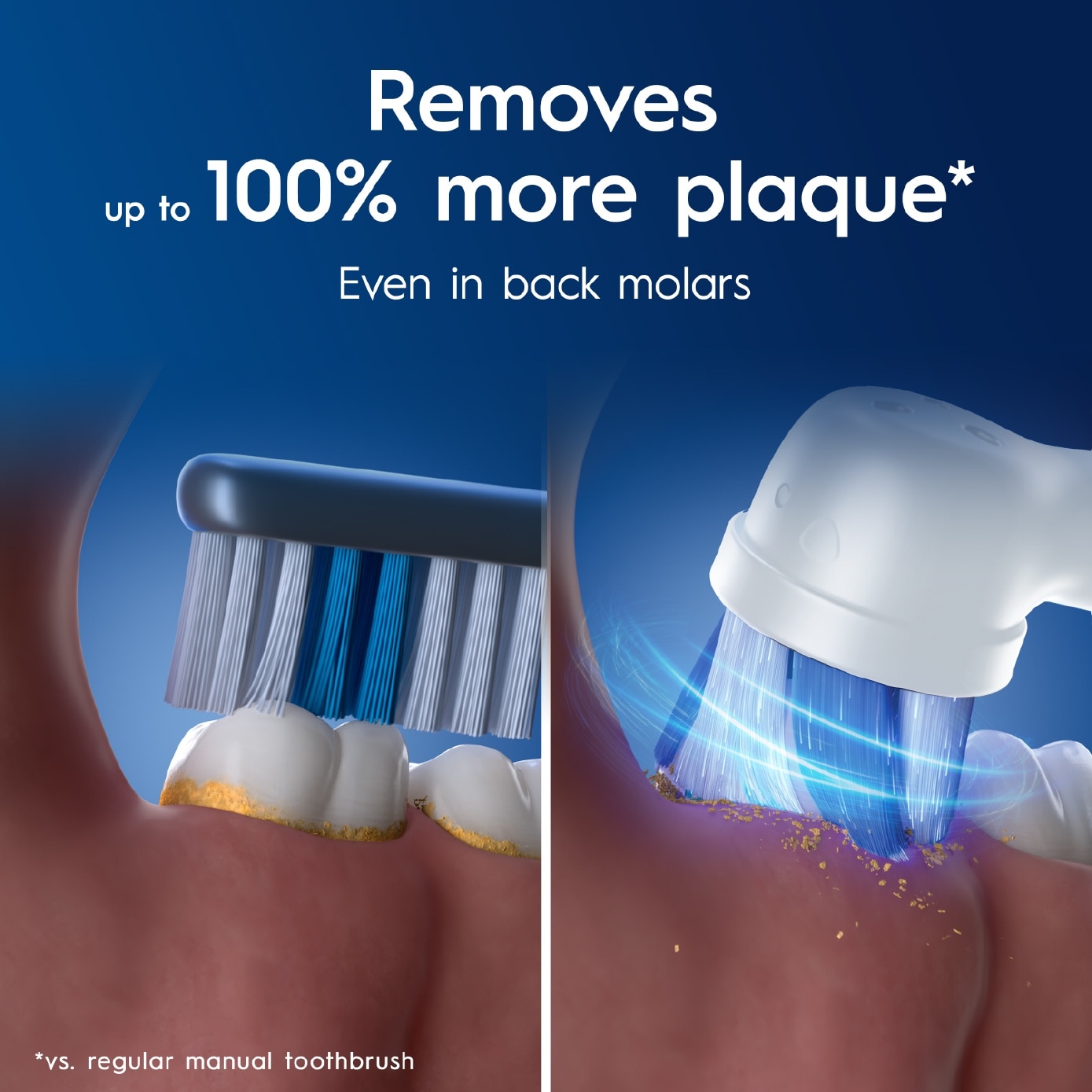 iO Series 2 Gentle Clean Sensitive White Electric Toothbrush 1s