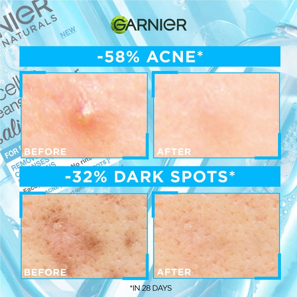 Micellar Water Salicylic Twinpack + Glow Buddy Blind Box (400ml x 2s) + 1s