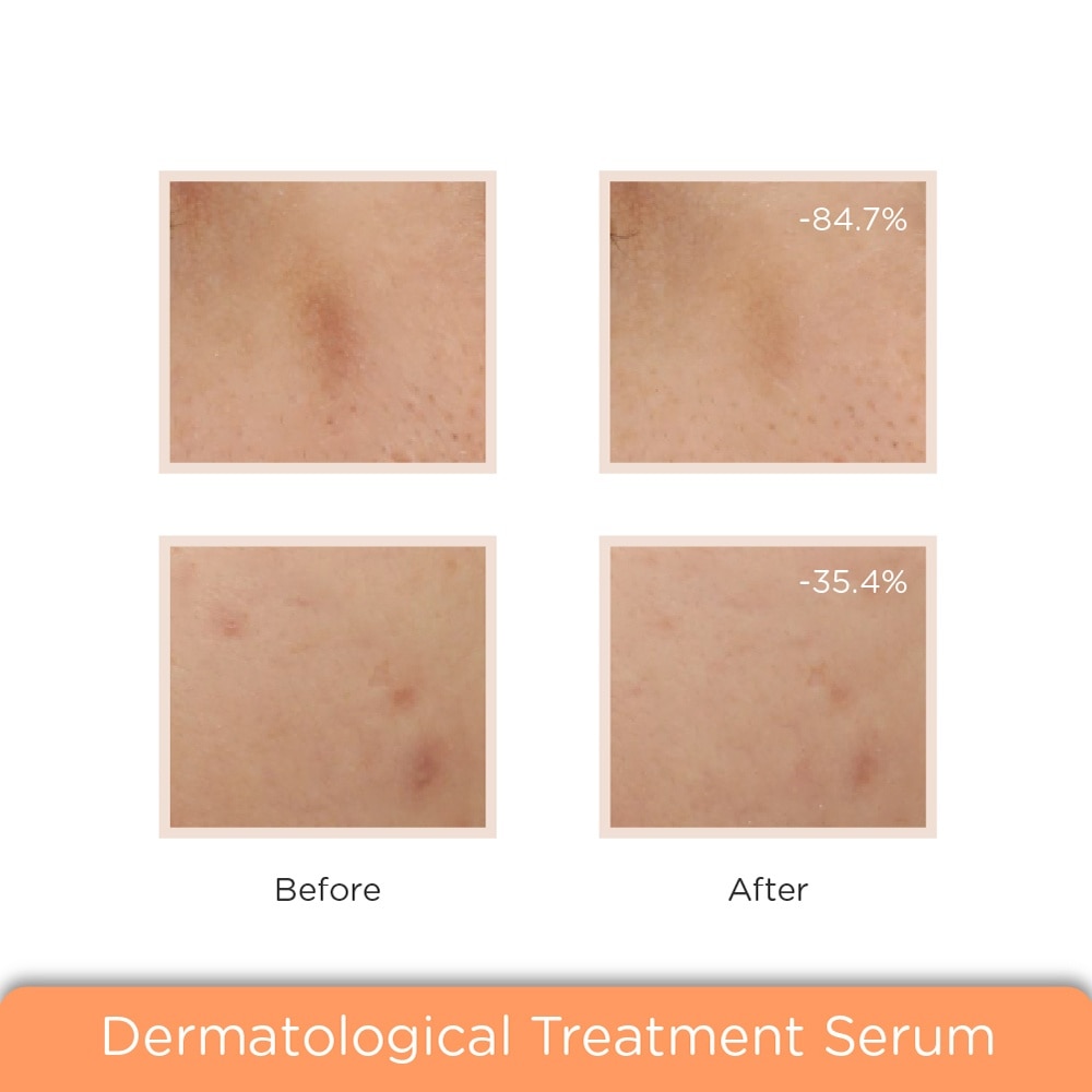 Lumiclar Pigmentation Corrective Serum 30ml